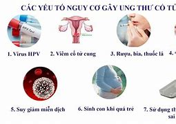 Viêm Cổ Tử Cung